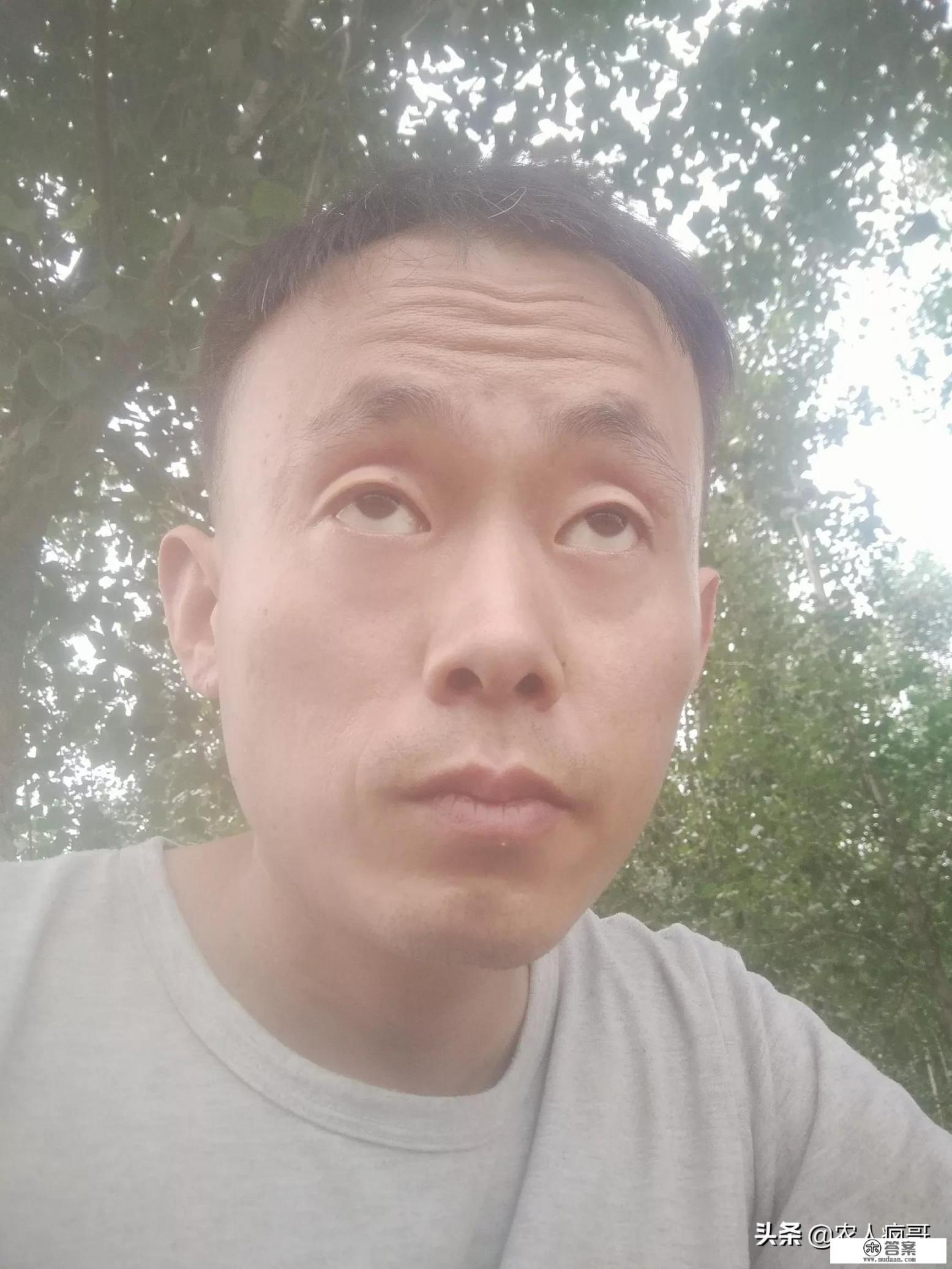 上海九院植发效果怎么样？