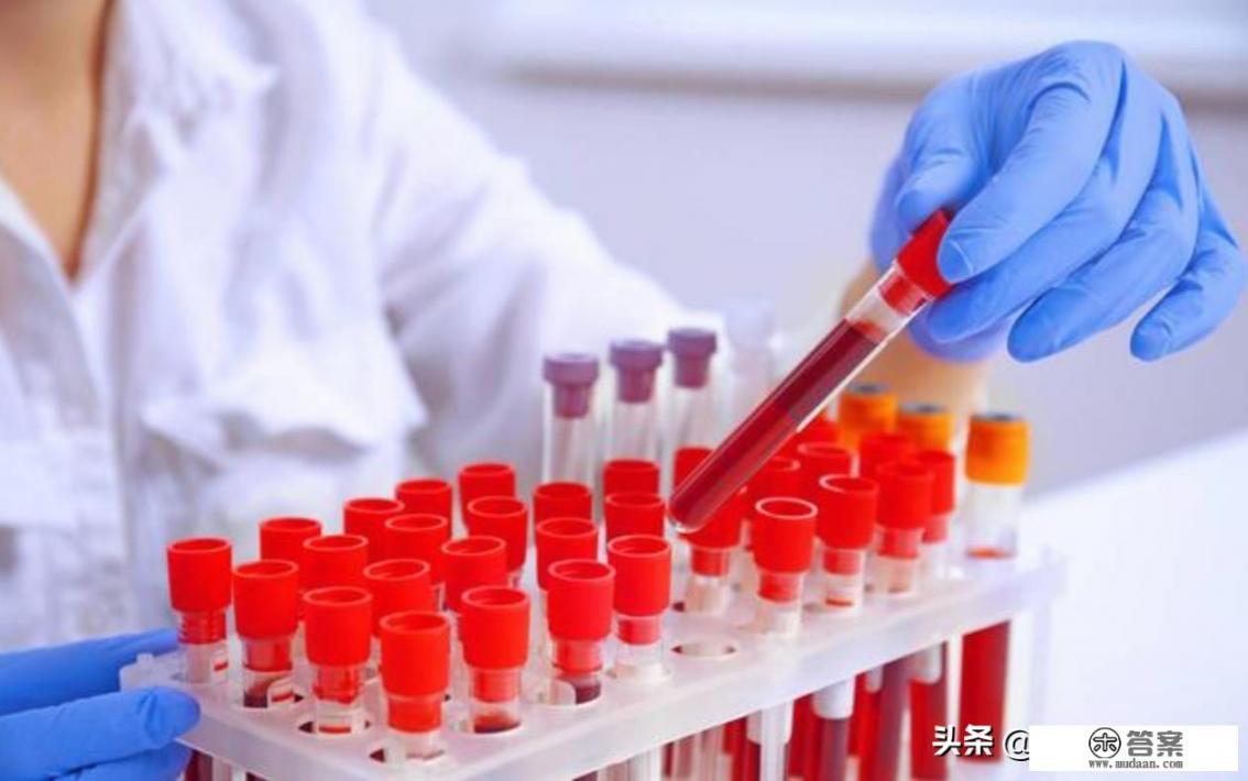 高血脂可以彻底治愈吗? 高血脂可以彻底治愈吗?