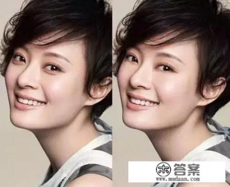 眼部整形都包括哪些? 眼部整形都包括哪些?