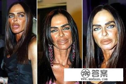 南昌时光整形是正规医院吗？