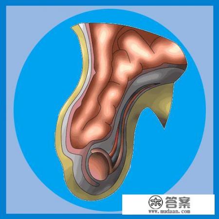 5岁多小孩疝气,哪种手术方式比较好?腹腔镜手术真的好吗? 5岁多小孩疝气,哪种手术方式比较好?腹腔镜手术真的好吗?