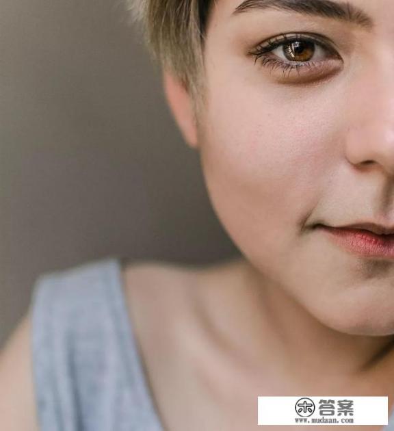 激光祛斑有什么副作用吗? 激光祛斑有什么副作用吗?