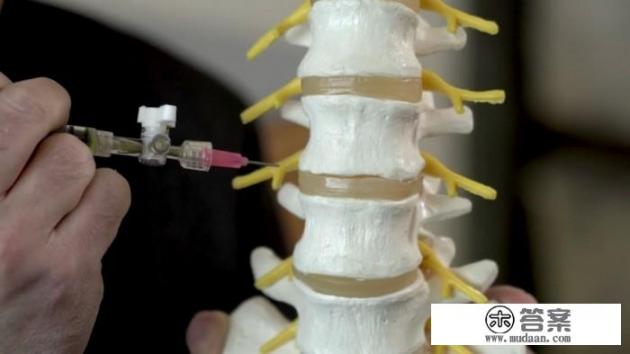 腰间盘突出如何治疗？