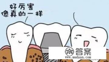 什么是种植牙，如何种植？