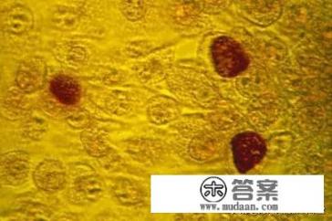 支原体感染是怎么回事？