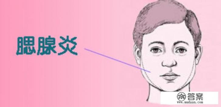 腮腺炎的症状及治疗办法是什么？