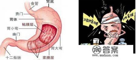 胃痉挛怎么办?怎么才能治疗好? 胃痉挛怎么办?怎么才能治疗好?