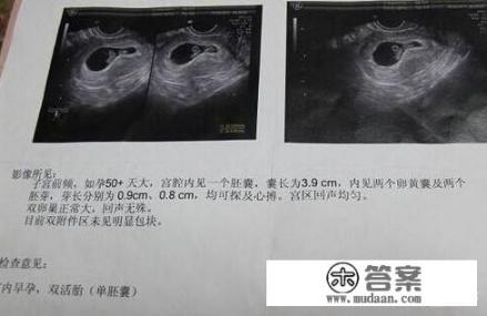 超声波与B超有什么区别吗? 超声波与B超有什么区别吗?