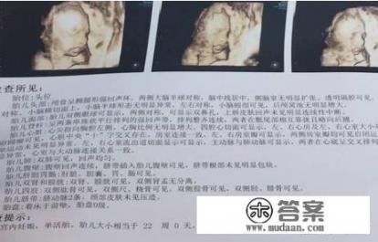 超声波与B超有什么区别吗? 超声波与B超有什么区别吗?