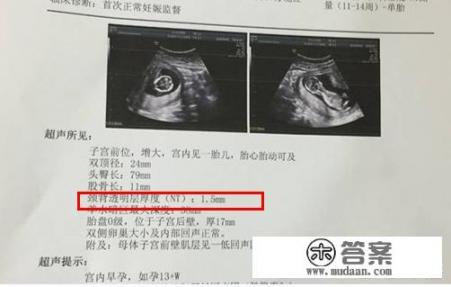 超声波与B超有什么区别吗? 超声波与B超有什么区别吗?