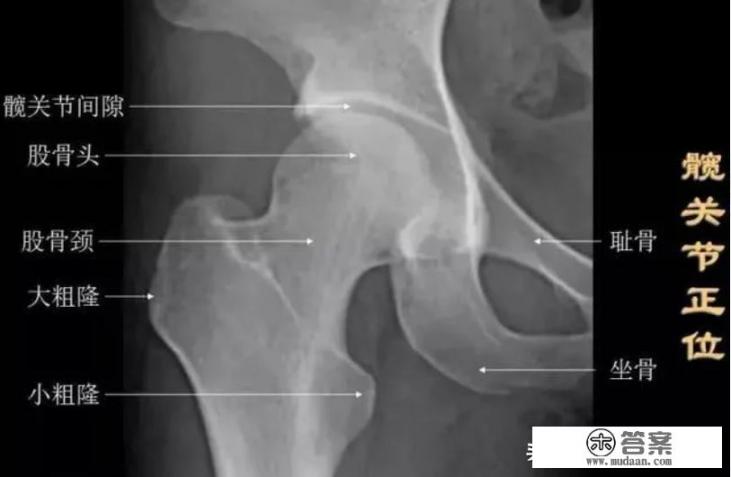 髋关节在什么部位？