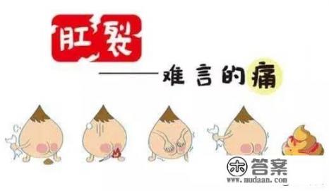 肛裂该怎么办? 肛裂该怎么办?