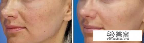 激光和光电有什么区别？