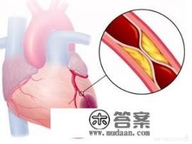 心梗如何自救? 心梗如何自救?