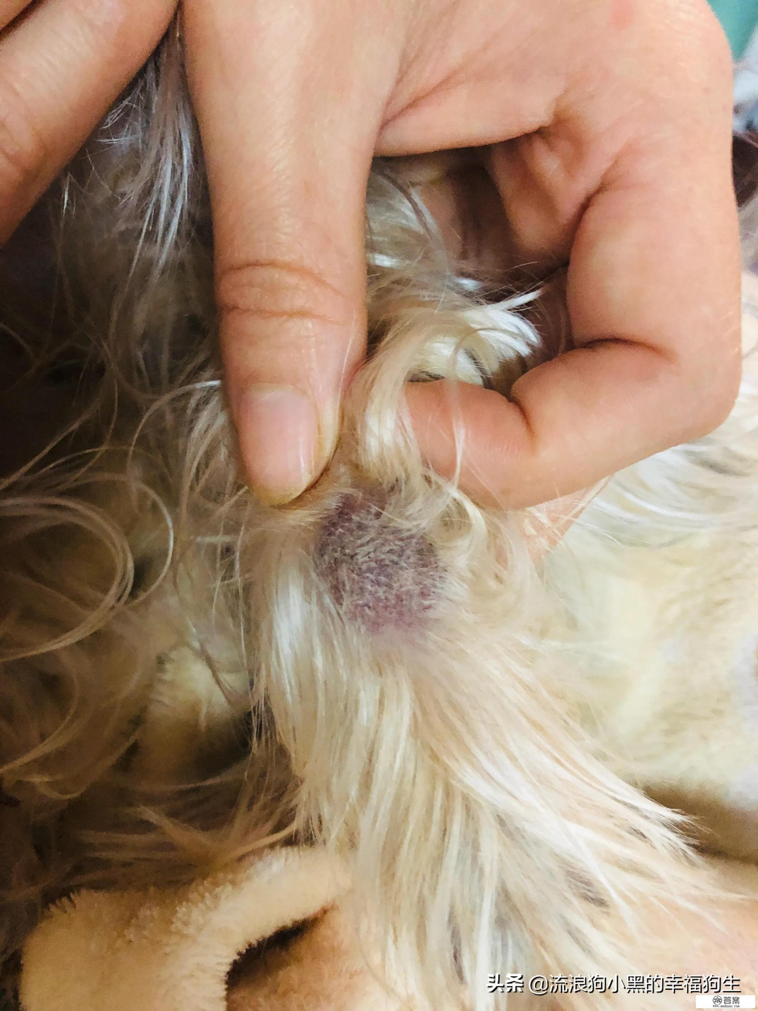 硝酸咪康唑乳膏与酮康唑乳膏有什么区别？