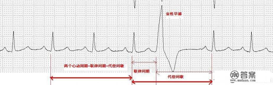 室性早搏，有什么症状？如何检查？哪些人要重视？怎么治疗？