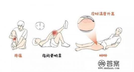 骨癌有什么症状？