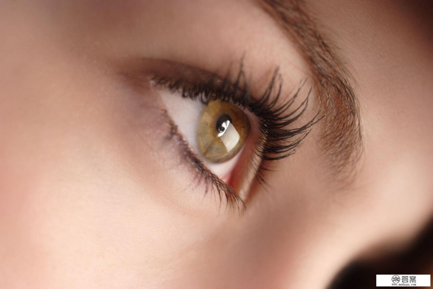 黑眼圈很重怎么改善？