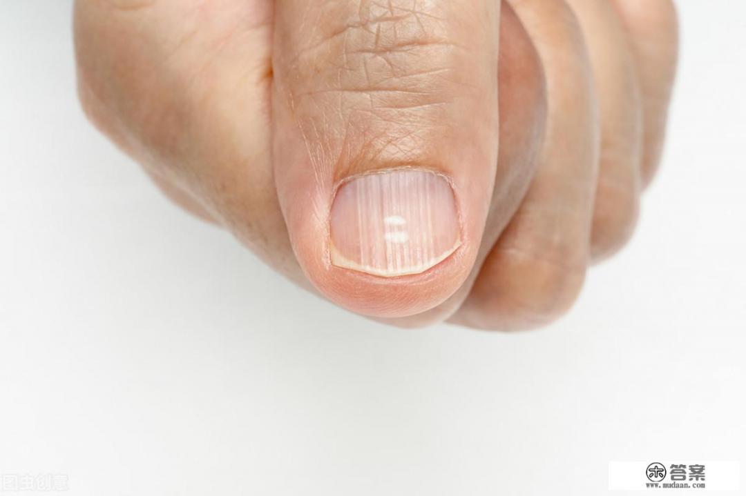 肝不好的表现有哪些？