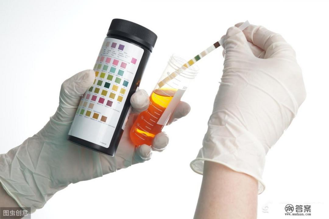 蛋白尿是怎么回事? 蛋白尿是怎么回事?