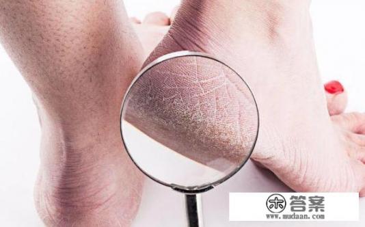 肝癌患者可以活多久? 肝癌患者可以活多久?