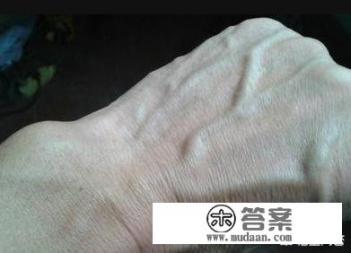 肝癌患者可以活多久? 肝癌患者可以活多久?