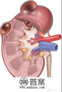 肾囊肿如何消除？