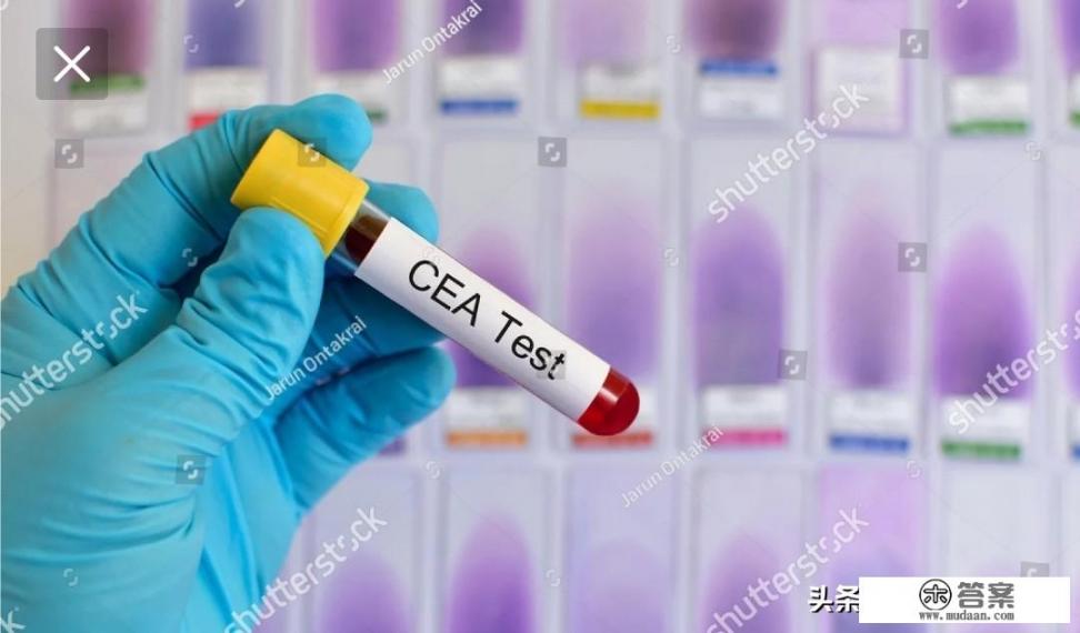 癌胚抗原是指什么？