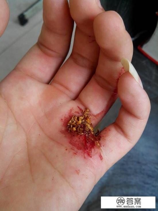 破伤风杆菌是什么？