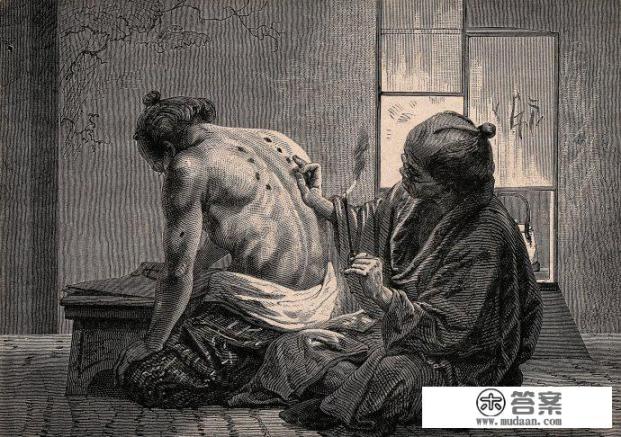 为什么感觉日本比中国更加重视艾灸? 为什么感觉日本比中国更加重视艾灸?