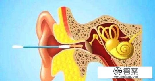耳朵进水怎么弄出来？