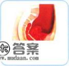 乳头变红是怀孕了吗?这是怎么回事呢? 乳头变红是怀孕了吗?这是怎么回事呢?