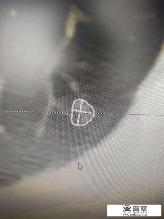 肺结节，怎么治疗，吃什么药物，能治好？