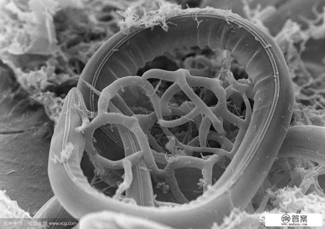 身体一般会有哪些寄生虫？