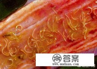 身体一般会有哪些寄生虫？