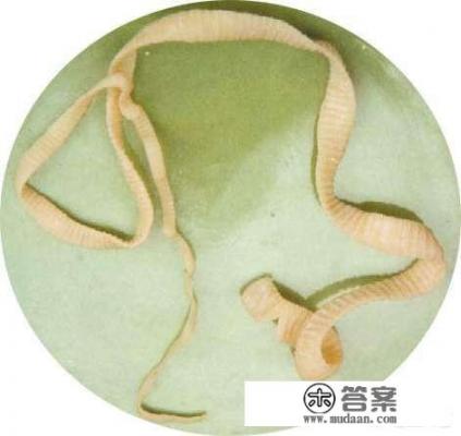 身体一般会有哪些寄生虫？