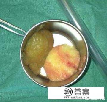 如何确定奥美定取出的最佳时机？