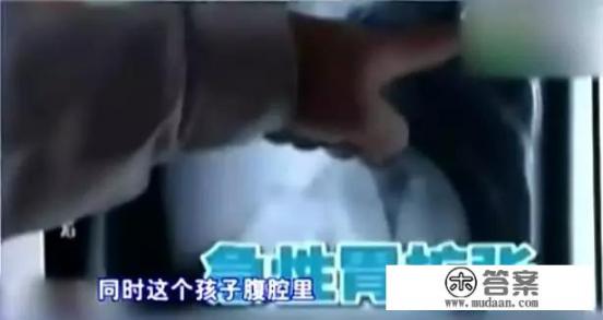 小朋友吃柿子有什么禁忌吗? 小朋友吃柿子有什么禁忌吗?