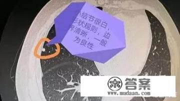 什么是结节?什么原因引起的呢? 什么是结节?什么原因引起的呢?