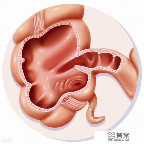 阑尾位于哪里？