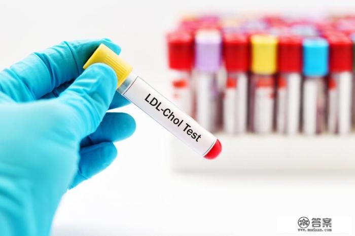 低密度脂蛋白3.3高吗,需要注意哪些健康问题? 低密度脂蛋白3.3高吗,需要注意哪些健康问题?