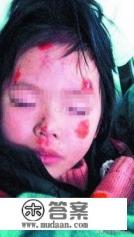 培根说“无论你怎样地表示愤怒都不要做出任何无法挽回的事来”。此话说的是否有道理？