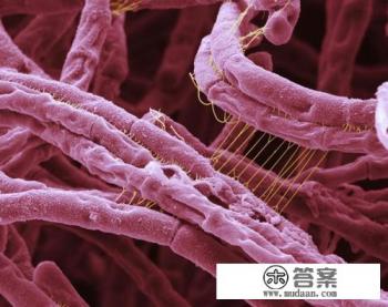 为什么成千上万的老鼠聚集一起会有鼠疫? 为什么成千上万的老鼠聚集一起会有鼠疫?