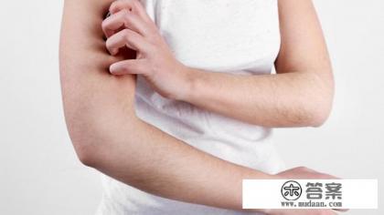 荨麻疹的别名？