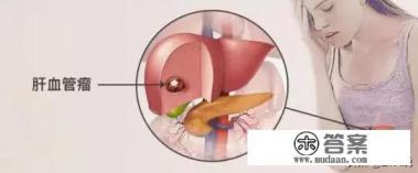 肝血管瘤怎么治最好，肝血管瘤的危害有哪些？