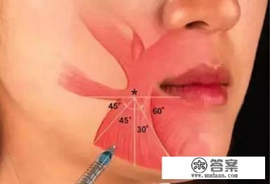 肉毒素对身体有哪些影响？