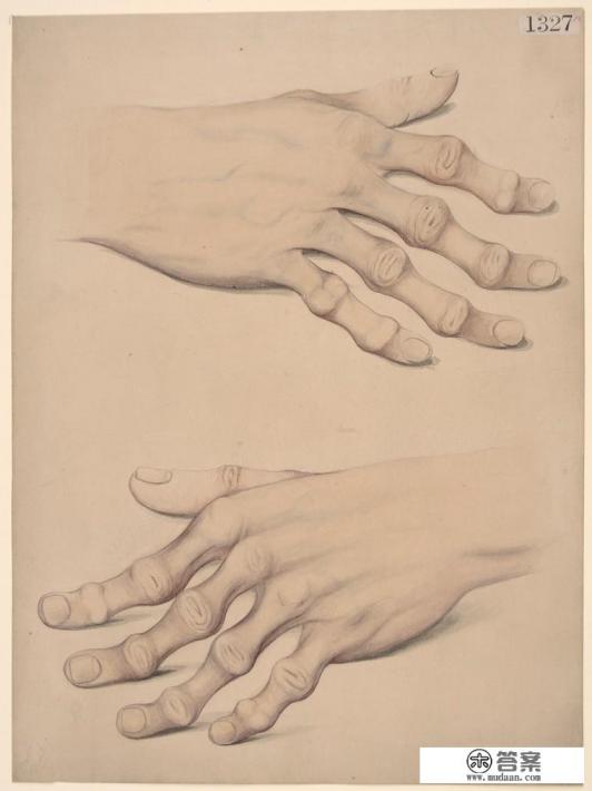 自身免疫疾病的病因有哪些？