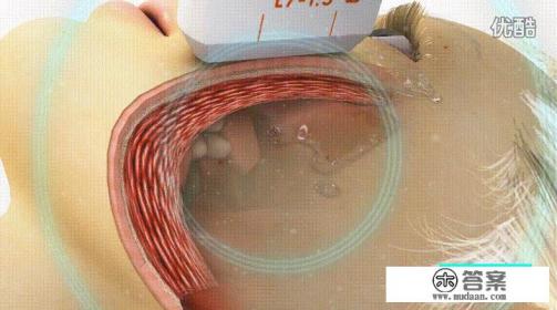 超声刀是怎么做的？