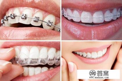 牙齿矫正一般多少钱？
