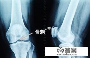 长期徒步旅行对身体伤害挺大的，每天走多少公里才健康？